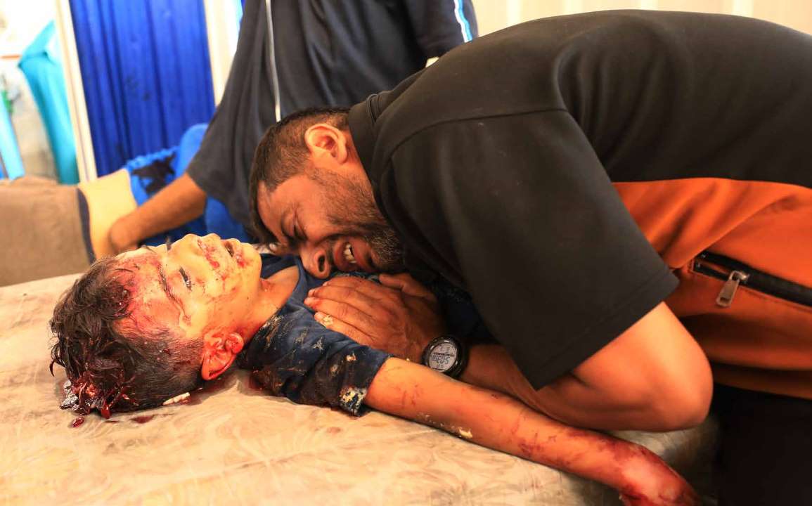 فلسطينيون ينقلون إلى مستشفى الأهلي المعمداني جثامين قتلى ومصابين، بينهم أطفال، سقطوا في هجوم شنته القوات الإسرائيلية على مدرستي الهدى والحمامة، حيث لجأ فلسطينيون تم تهجيرهم من حي الشيخ رضوان في شمال مدينة غزة.