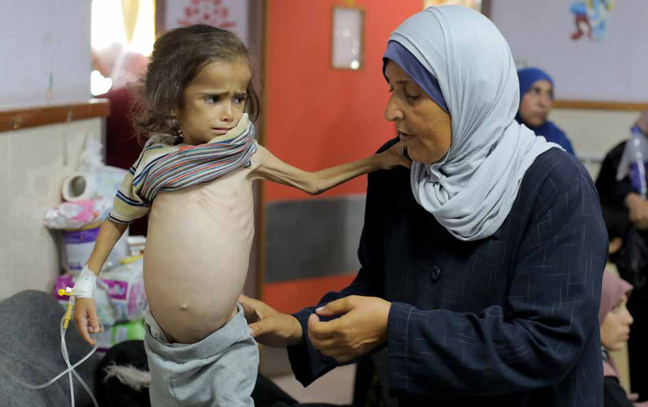 تشير التقارير إلى أن خطر وفاة الأطفال الفلسطينيين في قطاع غزة، الذي يتعرض لهجمات متواصلة من قبل الجيش الإسرائيلي منذ ثمانية أشهر وتغلق فيه المعابر مما يقيد دخول المساعدات الإنسانية، قد زاد بشكل كبير بسبب “سوء التغذية والجفاف”. الأطفال الذين يعانون من نقص التغذية يتلقون العلاج في مستشفى شهداء الأقصى في دير البلح، الذي يعاني أساسًا من نقص الموارد.