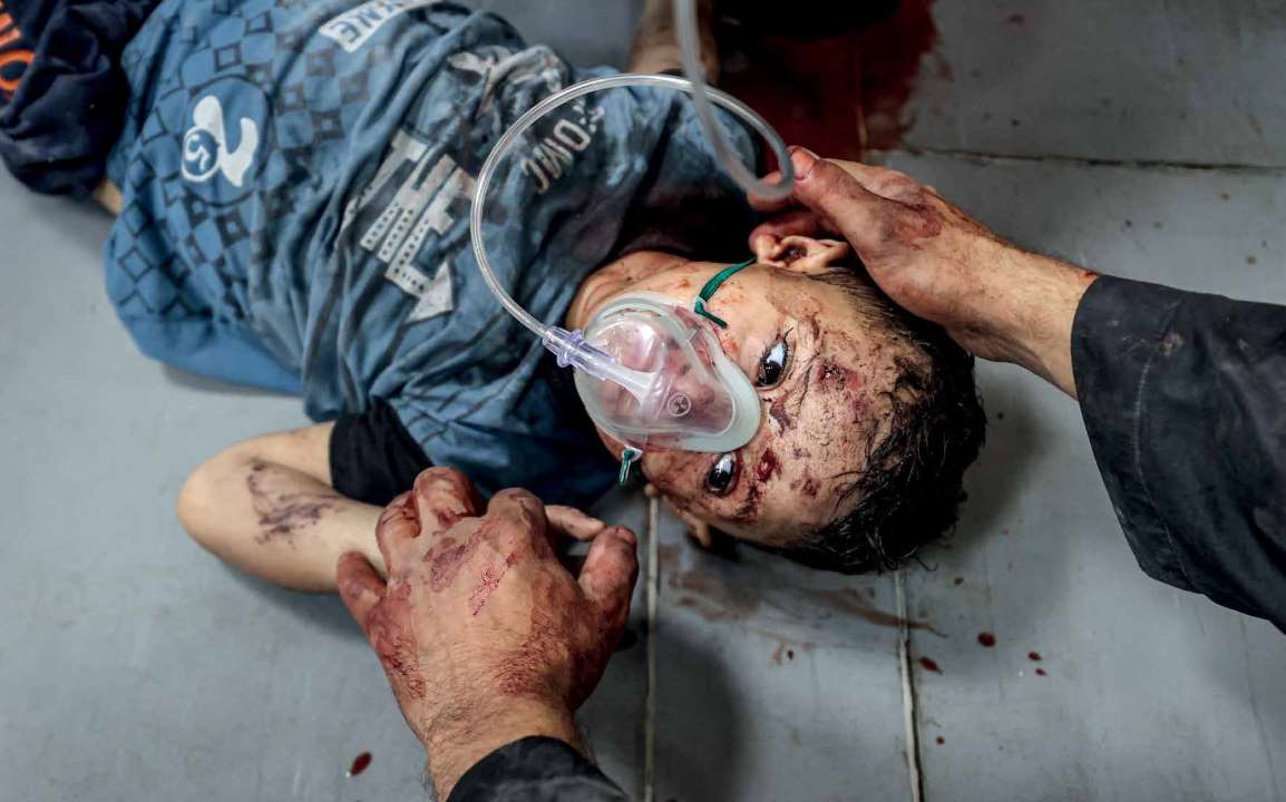 نقل عدد كبير من المصابين إلى مستشفى الشفاء، بعد الهجوم الجوي الذي شنه الجيش الإسرائيلي على مستشفى الأهلي المعمداني في مدينة غزة يوم 17 أكتوبر/ تشرين الأول 2023، وأسفر عن مقتل أكثر من 500 فلسطينيًا.