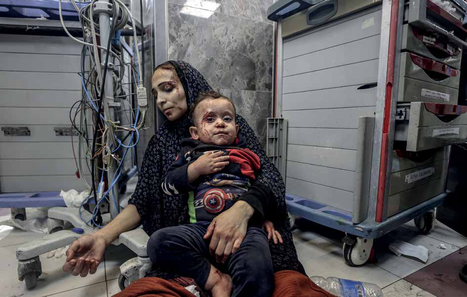 نقل العديد من المصابين الفلسطينيين إلى مستشفى الشفاء، بعد الهجوم الجوي الذي شنه الجيش الإسرائيلي على مستشفى الأهلي المعمداني في مدينة غزة في 17 أكتوبر/ تشرين الأول 2023، والذي أسفر عن مقتل أكثر من 500 شخص. في الصورة تظهر أم فلسطينية جريحة مع طفلها الجريح.