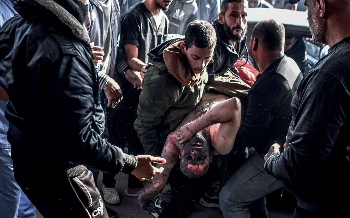 نقل فلسطيني مصاب بجروح خطيرة إلى مستشفى ناصر الطبي في خان يونس، عقب قصف للجيش الإسرائيلي استهدف المدينة.