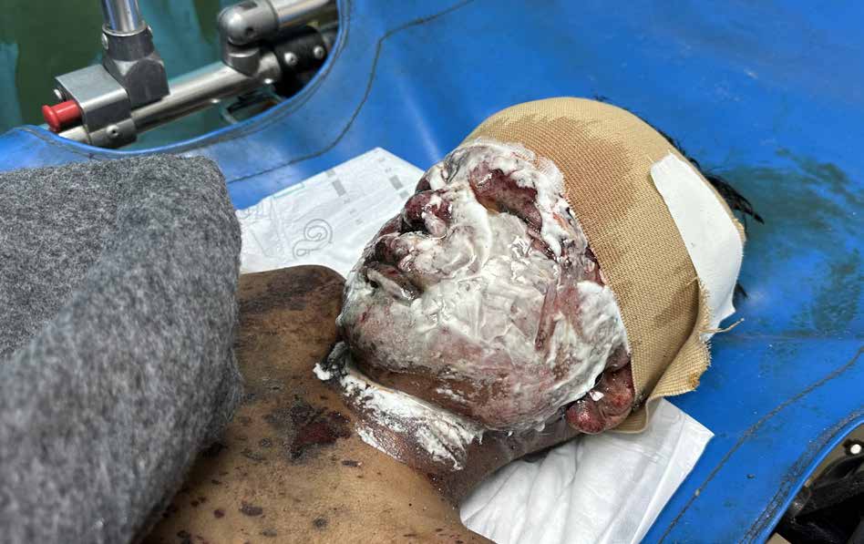 نقل مصابين فلسطينيين، بينهم أطفال، إلى مستشفى شهداء الأقصى في مدينة دير البلح، سقطوا نتيجة الغارات الجوية الإسرائيلية المكثفة والمتواصلة على قطاع غزة المحاصر.