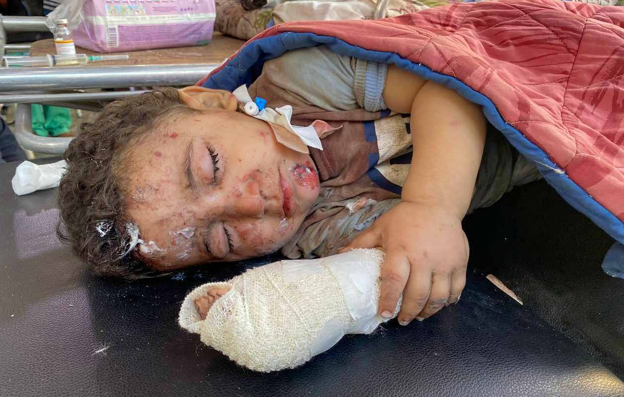 نقل طفل فلسطيني أصيب خلال الهجمات الإسرائيلية المتواصلة على القطاع، إلى مستشفى الاهلي المعمداني في غزة.