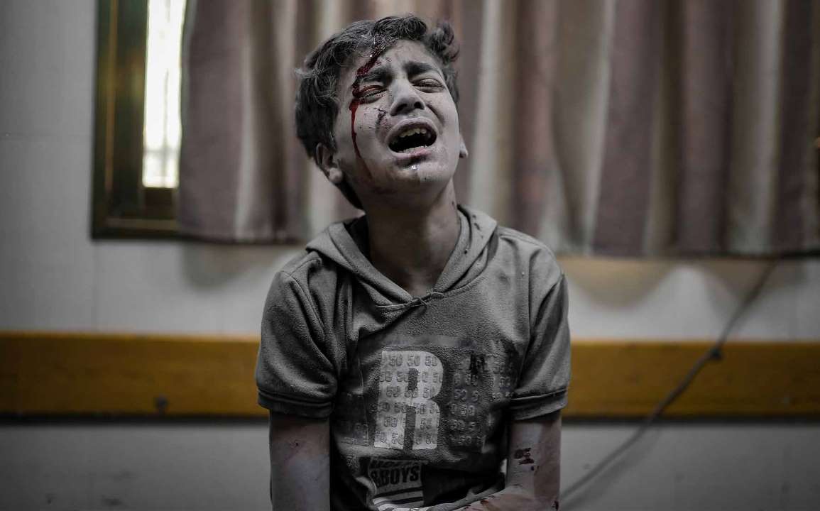طفل فلسطيني جرى نقله إلى مستشفى ناصر في خان يونس، يصرخ من شدة الألم، في اليوم الثاني والثلاثين من الهجمات التي تشنها القوات الإسرائيلية على قطاع غزة.