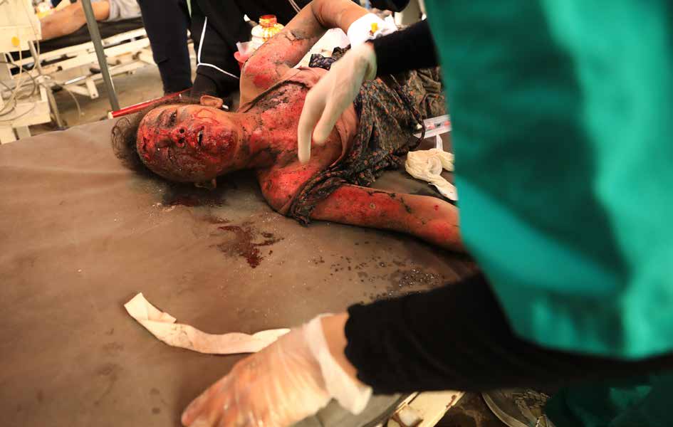 نقل قتلى وجرحى فلسطينيين بينهم أطفال، إلى المستشفى الأهلي العربي المعمداني، سقطوا في هجمات شنها الجيش الإسرائيلي على مدارس الهدى والحمامة، التي لجأ إليها فلسطينيون نازحون في حي الشيخ الرضوان شمال مدينة غزة.