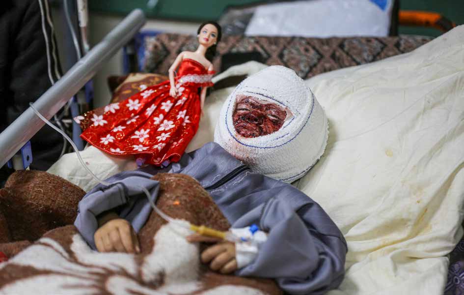 تتواصل معاناة الطفلة الفلسطينية سجى جنيد، التي تعرضت لحروق عميقة في وجهها وجسمها نتيجة استهداف الجيش الإسرائيلي لمنزلها في مخيم جباليا للاجئين شمال غزة. تعاني سجى من آلام شديدة وتكافح من أجل البقاء على قيد الحياة. وأثناء تلقيها العلاج في مستشفى الشفاء، تعرضت سجى مرة أخرى لهجمات شنها الجيش الإسرائيلي، ما اضطر والدها إلى نقل ابنته المصابة بالحروق إلى مستشفى شهداء الأقصى في دير البلح.