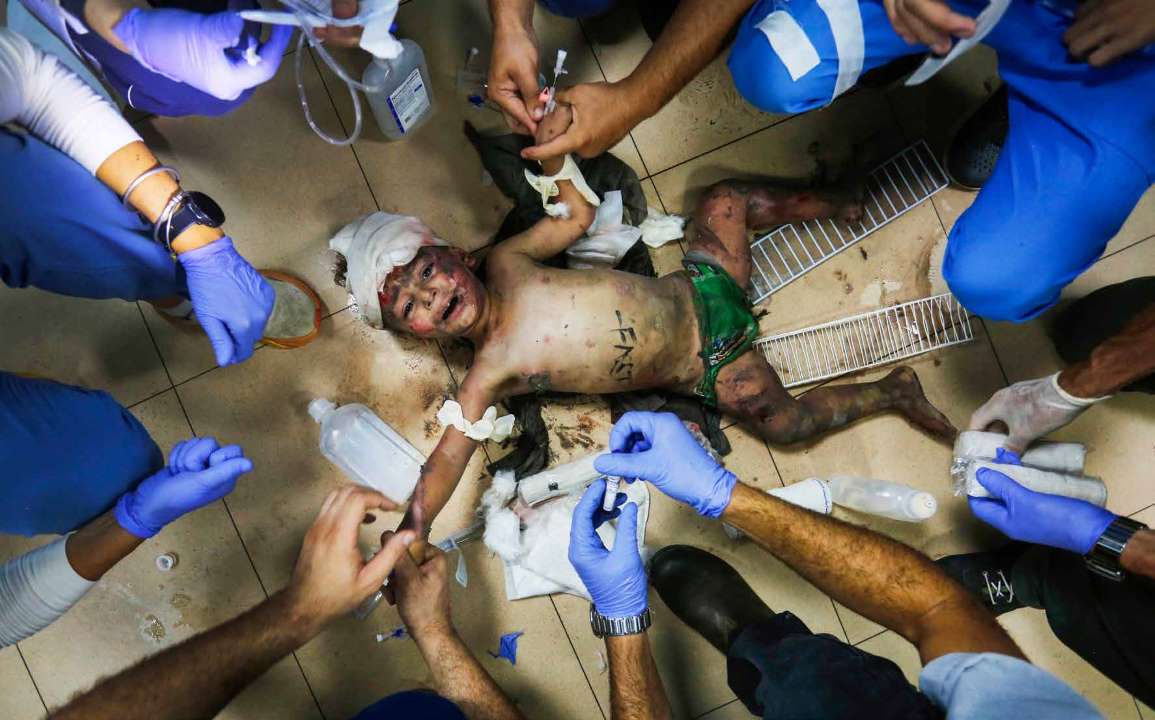 طفل فلسطيني يتلقى العلاج في مستشفى شهداء الأقصى في دير البلح، على ضوء هاتف محمول، بعد إصابته في هجوم شنه الجيش الإسرائيلي، وما رافق الهجوم من انقطاع للتيار الكهربائي.